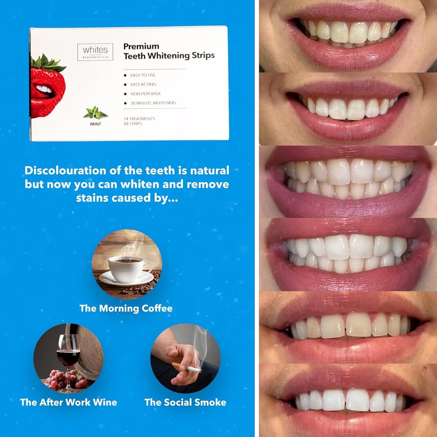 Whites Beaconsfield Teeth Whitening Strips